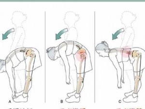 人们为什么总是弯着腰弓着身子？这种姿势对身体有何影响？如何保持正确的姿势？