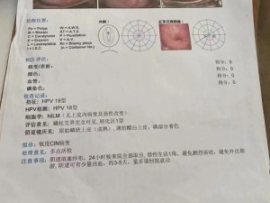 长日光阴HPV18—长日光阴 HPV18，它到底是什么？