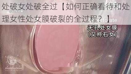 处破女处破全过【如何正确看待和处理女性处女膜破裂的全过程？】