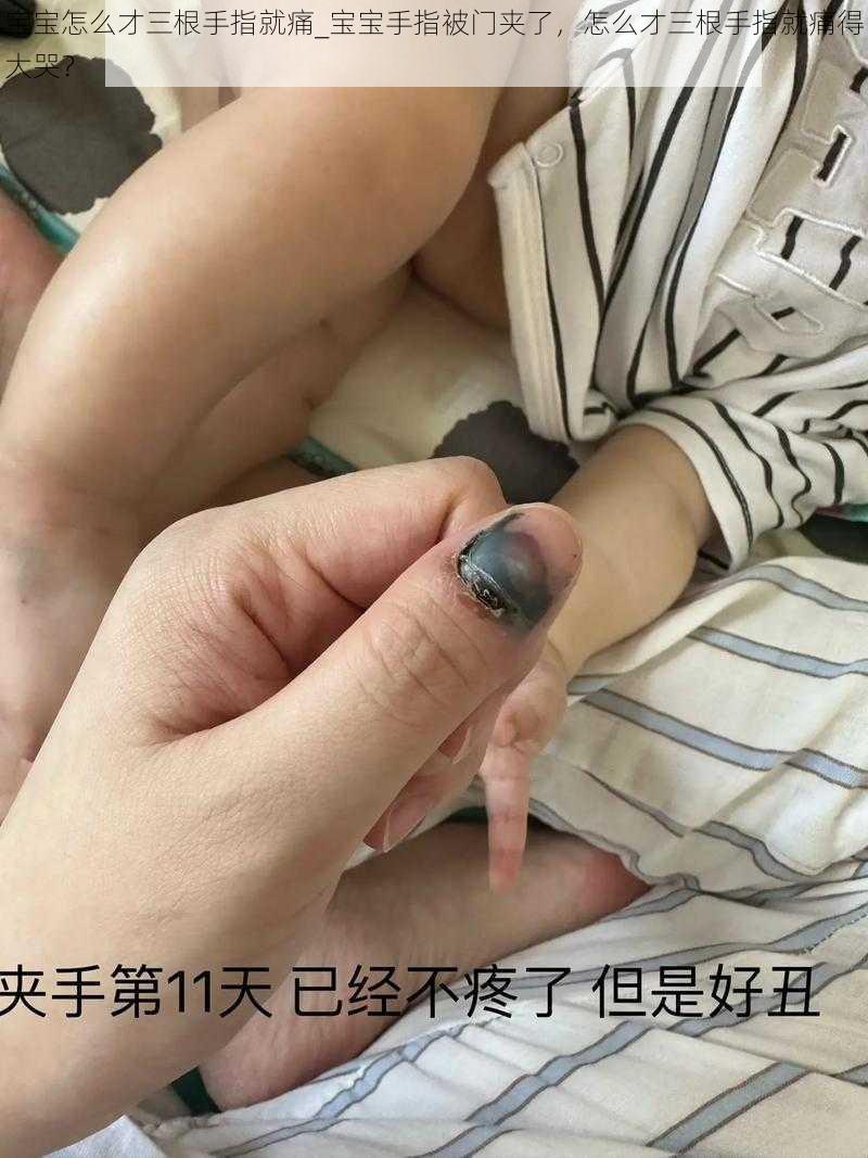 宝宝怎么才三根手指就痛_宝宝手指被门夹了，怎么才三根手指就痛得大哭？