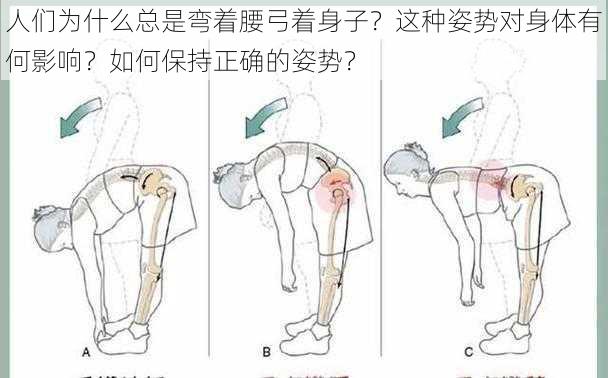 人们为什么总是弯着腰弓着身子？这种姿势对身体有何影响？如何保持正确的姿势？